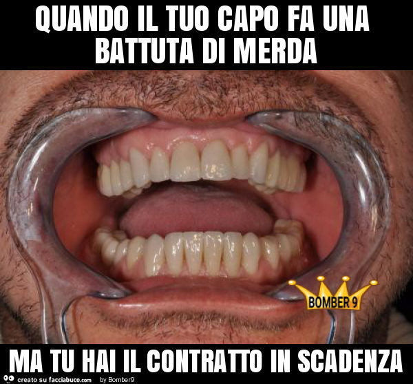 Quando il tuo capo fa una battuta di merda ma tu hai il contratto in scadenza