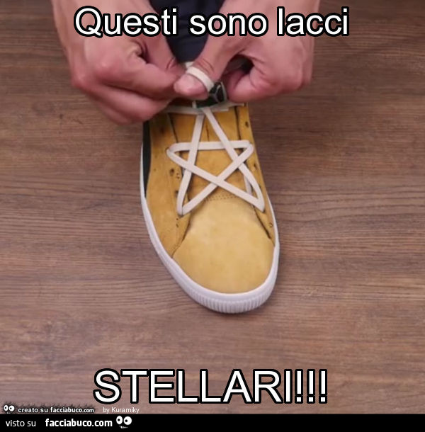 Questi sono lacci stellari